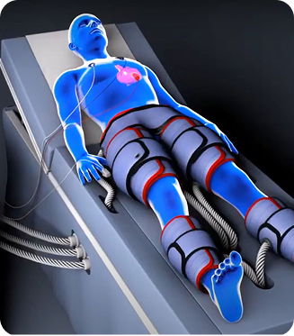 EECP Treatment